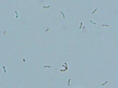 Dacryobolus karstenii