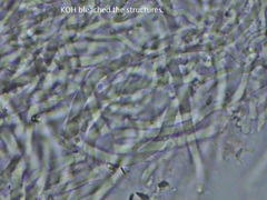 Hydnophlebia