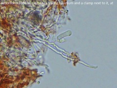 Hydnophlebia
