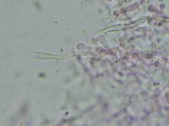 Hydnophlebia