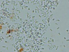 Hydnophlebia
