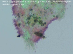 Hydnophlebia