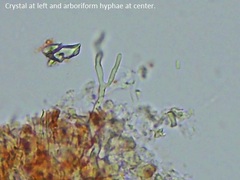 Hydnophlebia