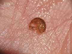 Ischyrocerus anguipes