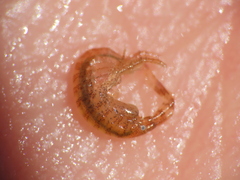 Ischyrocerus anguipes