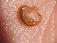 Ischyrocerus anguipes