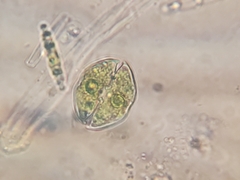 Cosmarium pseudotaxichondrum