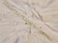 Pleurotaenium sceptrum