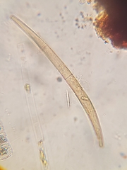 Closterium striolatum