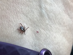 Dermacentor similis
