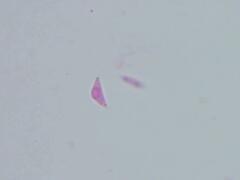 Mitrula lunulatospora