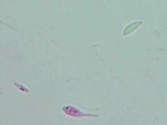 Mitrula lunulatospora