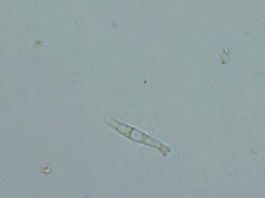 Mitrula lunulatospora