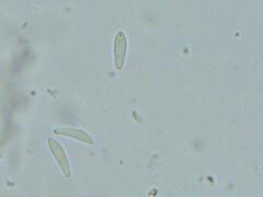 Mitrula lunulatospora