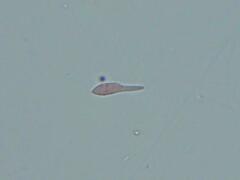 Mitrula lunulatospora