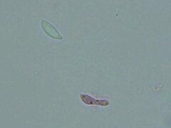 Mitrula lunulatospora