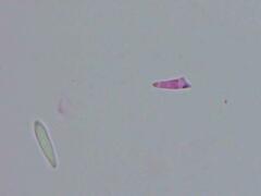 Mitrula lunulatospora