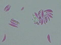 Mitrula lunulatospora