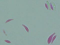 Mitrula lunulatospora