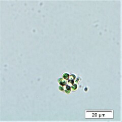 Coelastrum microporum