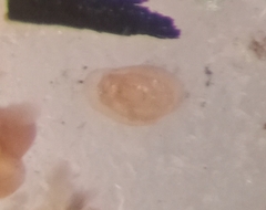 Miliammina obliqua