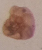 Paratrochammina