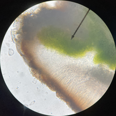 Acarospora glaucocarpa