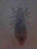 Pediculus humanus capitis