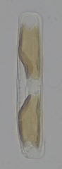Climaconeis