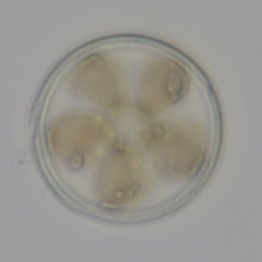 Actinocyclus