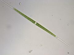 Closterium idiosporum