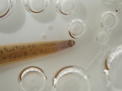 Erpobdella octoculata