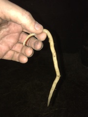 Ascaris lumbricoides