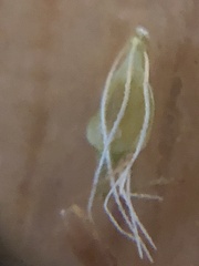 Rhynchospora microcephala