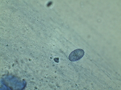 Scutellinia olivascens