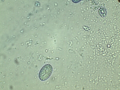 Scutellinia olivascens