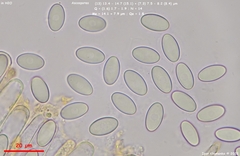 Cheilymenia stercorea
