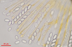 Cheilymenia stercorea