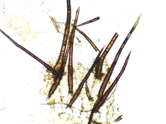 Scutellinia olivascens