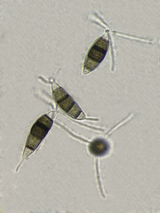Pestalotiopsis