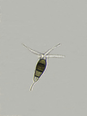 Pestalotiopsis