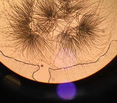 Gloeotrichia echinulata