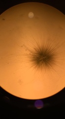 Gloeotrichia echinulata