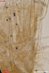 Lasiobolus macrotrichus