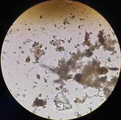 Fragilaria capucina