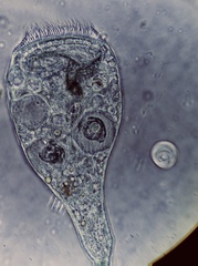 Stentor coeruleus