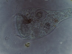 Stentor coeruleus
