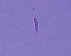 Hymenoscyphus scutula