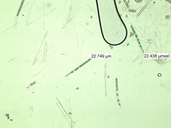 Scutellinia olivascens