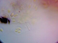 Bachmanniomyces punctum